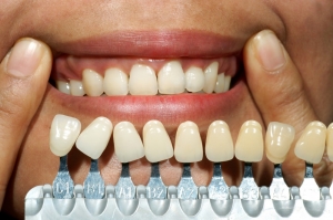 The Solution to Missing Teeth: Dental Implants Explained
